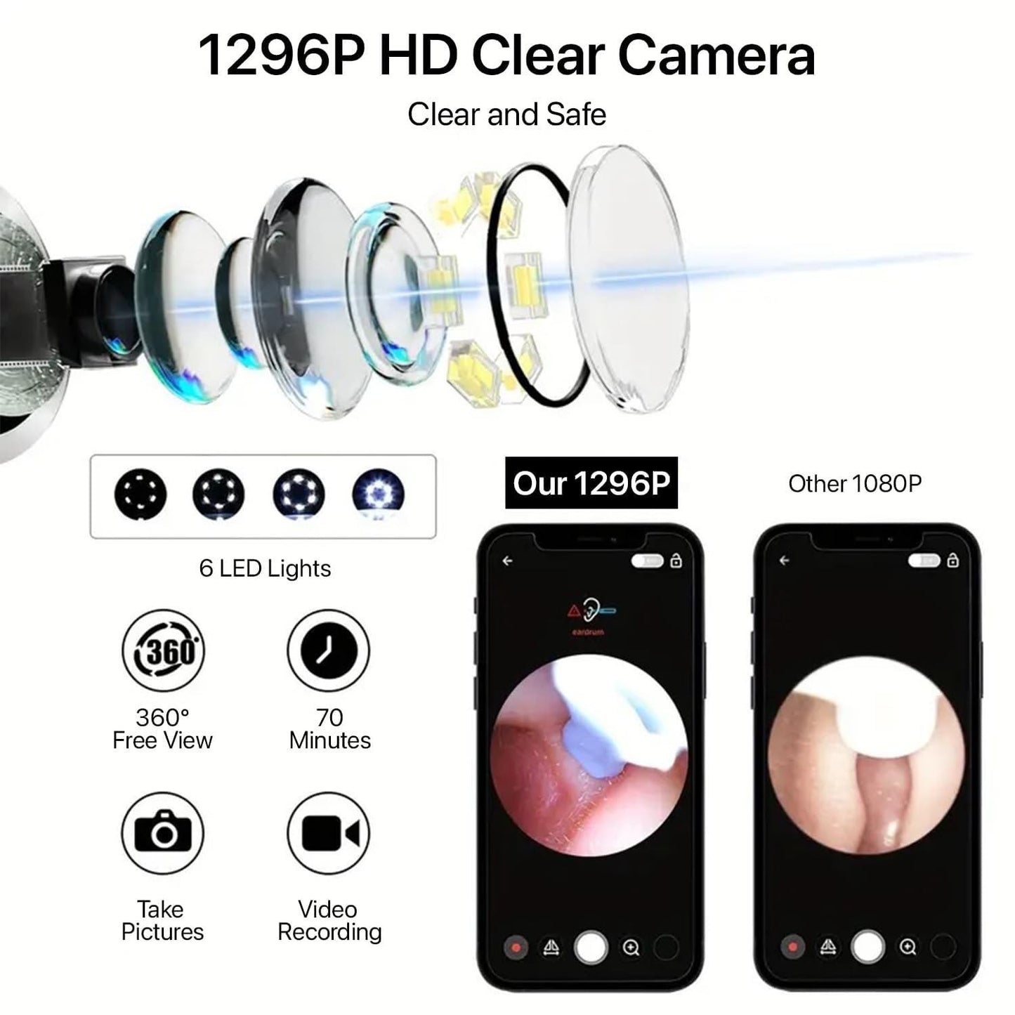 Earwax Removal Tool Kit with HD Camera Wi-Fi Connection