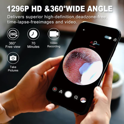 Earwax Removal Tool Kit with HD Camera Wi-Fi Connection